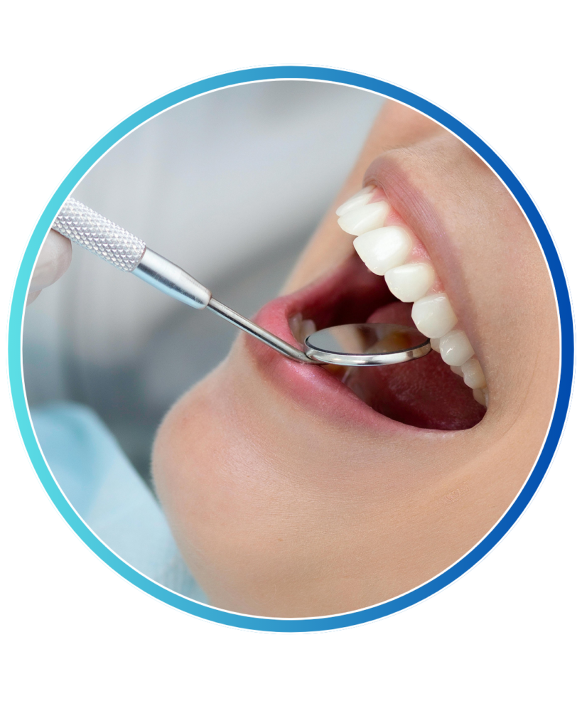 Cosmetic Fillings in Bangalore