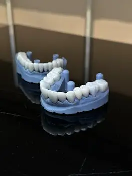 Close-up of dental models, highlighting tooth alignment and structure on a glossy surface.