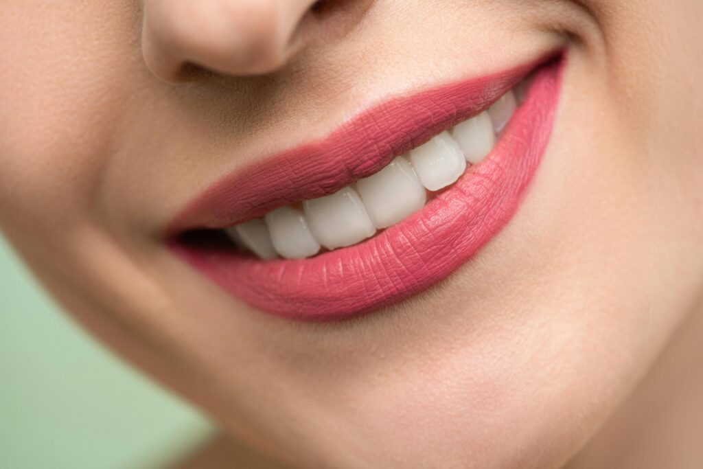 Teeth Whitening In Bangalore
