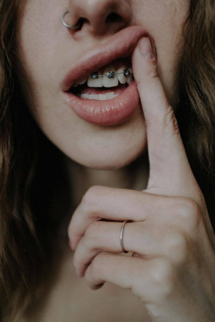 Close-up of a young woman's mouth showing braces and a nose piercing.